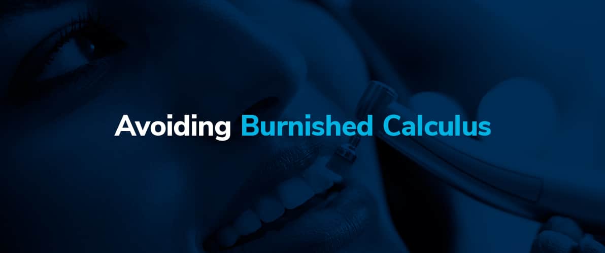 avoiding-burnished-calculus-banner