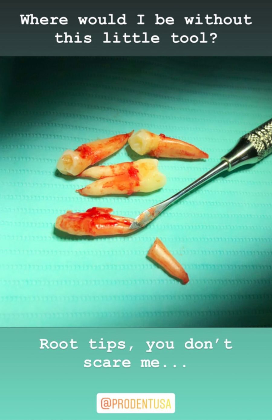 root-tip-instagram-post